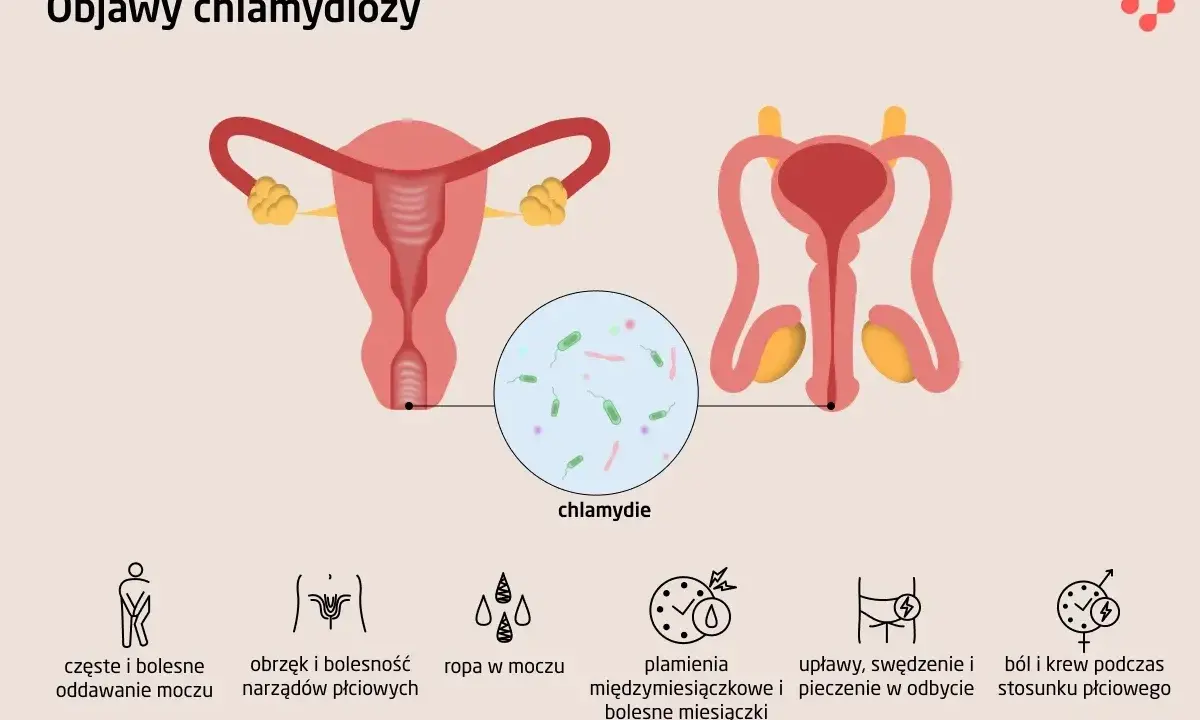 Ilustracja przedstawia układ rozrodczy kobiety i mężczyzny. U mężczyzn chlamydia może objawiać się bólem podczas oddawania moczu i stosunku.