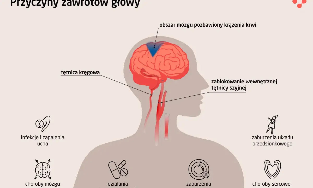Ilustracja przedstawia przyczyny zawrotów głowy: blokadę tętnicy szyjnej, problemy z tętnicą kręgową, choroby mózgu, infekcje ucha, zaburzenia metaboliczne, sercowo-naczyniowe, układu przedsionkowego i działania niepożądane leków.