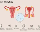 Ilustracja przedstawia układ rozrodczy kobiety i mężczyzny. U mężczyzn chlamydia może objawiać się bólem podczas oddawania moczu i stosunku.