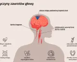Ilustracja przedstawia przyczyny zawrotów głowy: blokadę tętnicy szyjnej, problemy z tętnicą kręgową, choroby mózgu, infekcje ucha, zaburzenia metaboliczne, sercowo-naczyniowe, układu przedsionkowego i działania niepożądane leków.