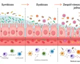 Ilustracja pokazuje, co to jest immunologia jelitowa: od symbiozy, przez dysbiozę, po zespół nieszczelnego jelita i reakcję zapalną.