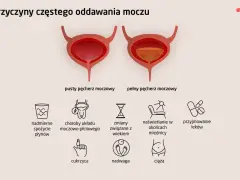 Ilustracja pokazuje pęcherz pusty i pełny, wyjaśniając przyczyny częstego oddawania moczu: nadmierne picie, choroby, wiek, naświetlanie, leki, cukrzyca, nadwaga, ciąża.