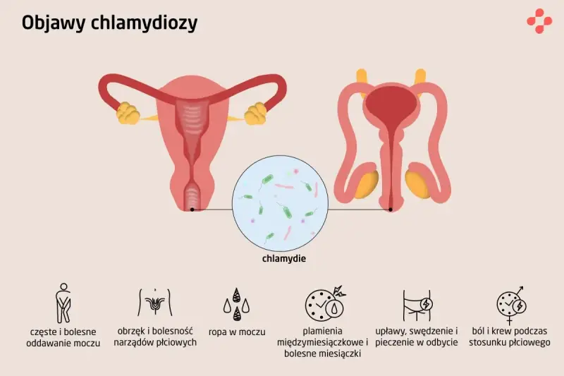 Ilustracja przedstawia układ rozrodczy kobiety i mężczyzny. U mężczyzn chlamydia może objawiać się bólem podczas oddawania moczu i stosunku.